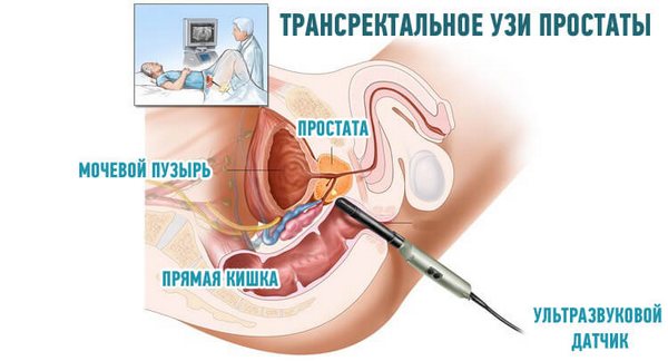 УЗИ простаты