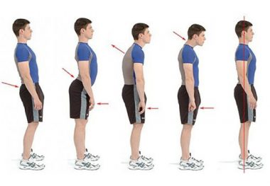 Виды искривления позвоночника