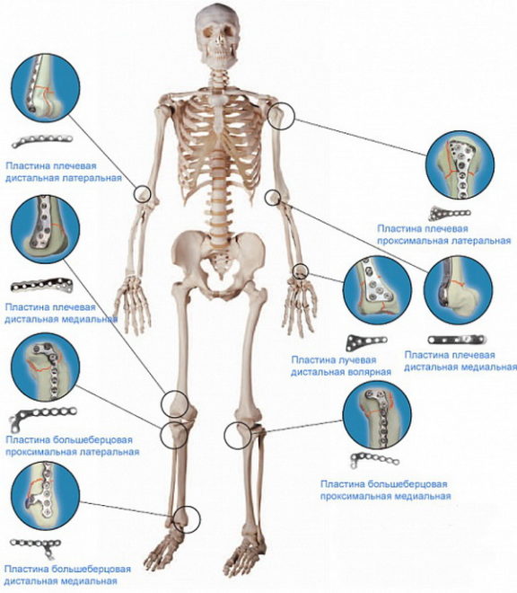 Виды пластин