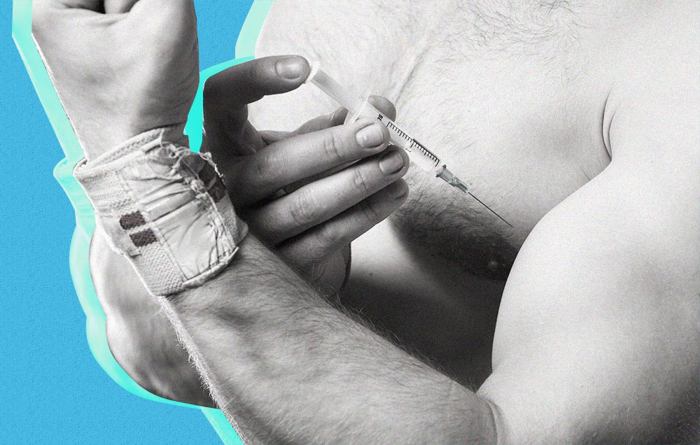 Инъекции стероидов в бодибилдинге