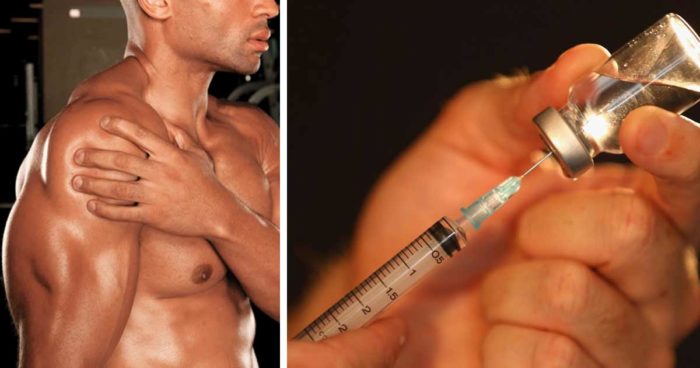 Укол стероидов