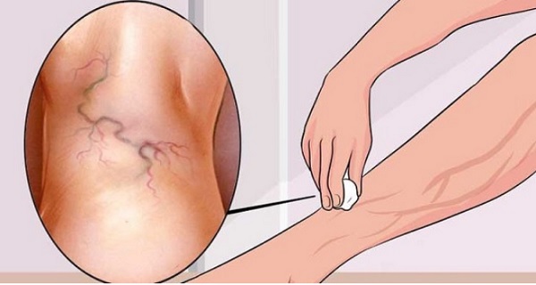 усталость ног