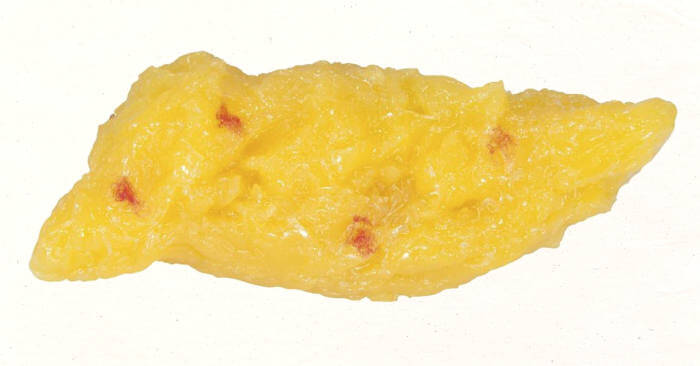 Жировая ткань