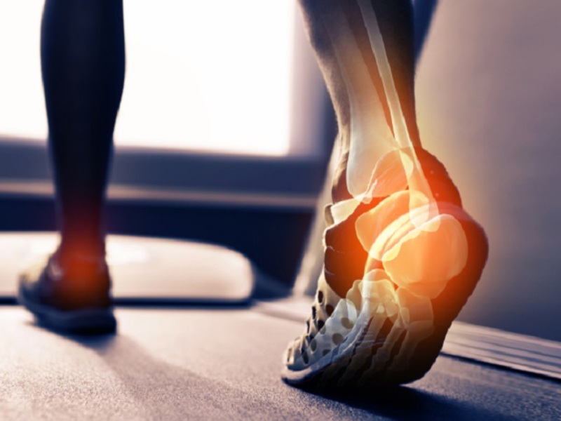 суставы стопы