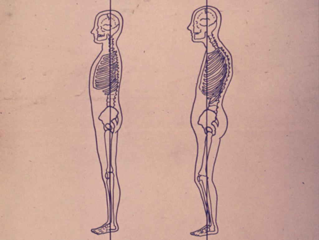 Сравнение сутулости и естественных изгибов