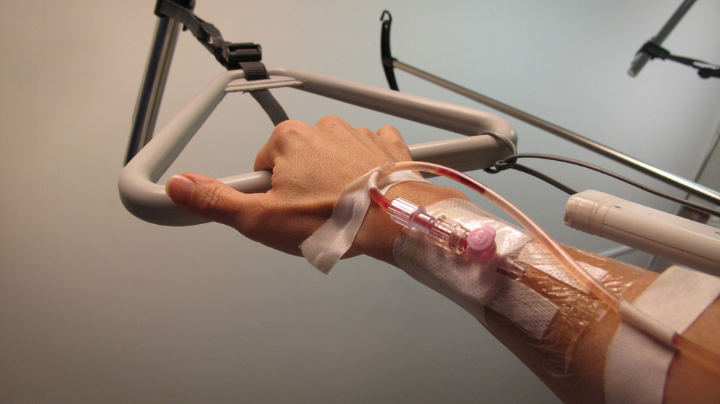 Рука с введенным катетером от капельницы