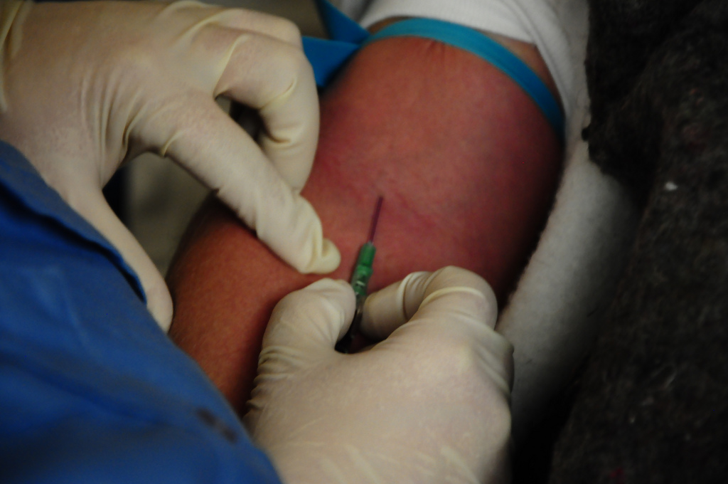 Процесс ввода катетера в вену на руке