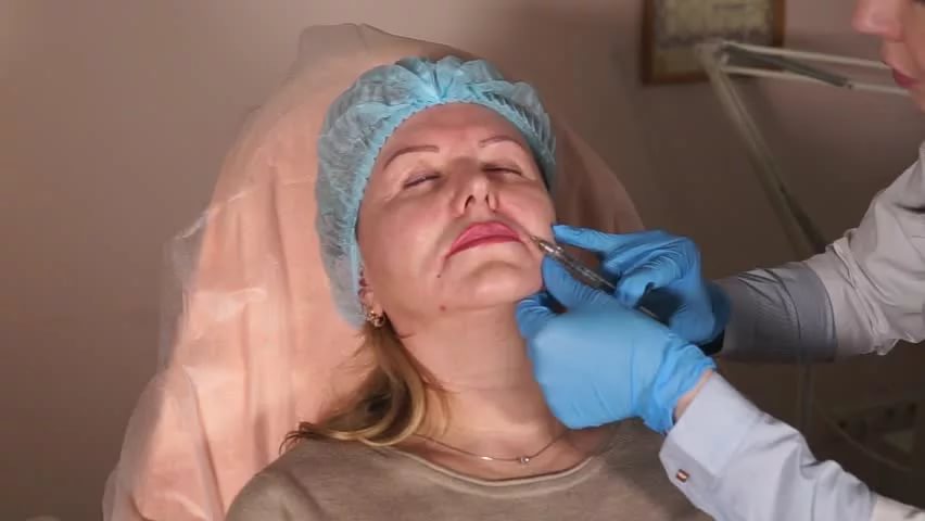 Филлеры при асимметрии