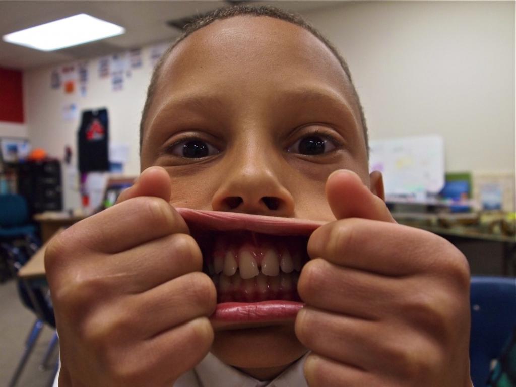 Большие губы