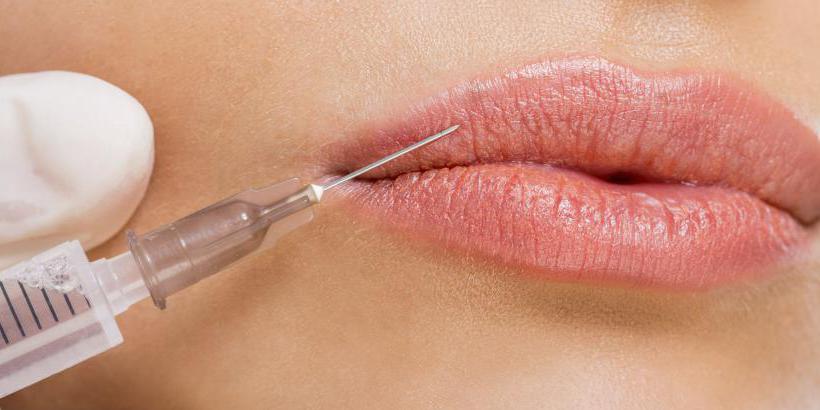 Коррекция губы