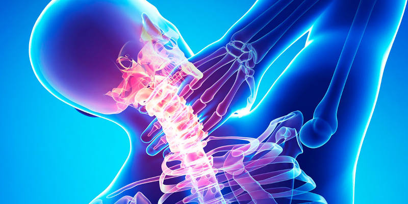 можно ли делать планку при шейном остеохондрозе