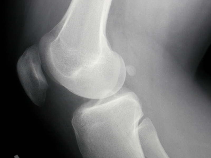 глюкозамин хондроитин инструкция