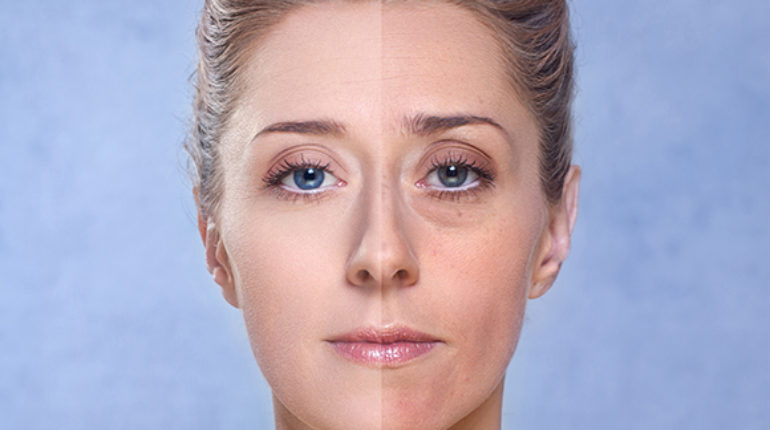 зона асимметрии