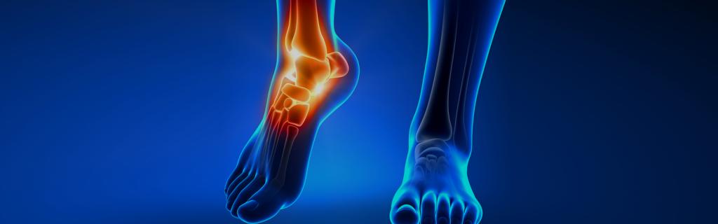 Голеностопный сустав