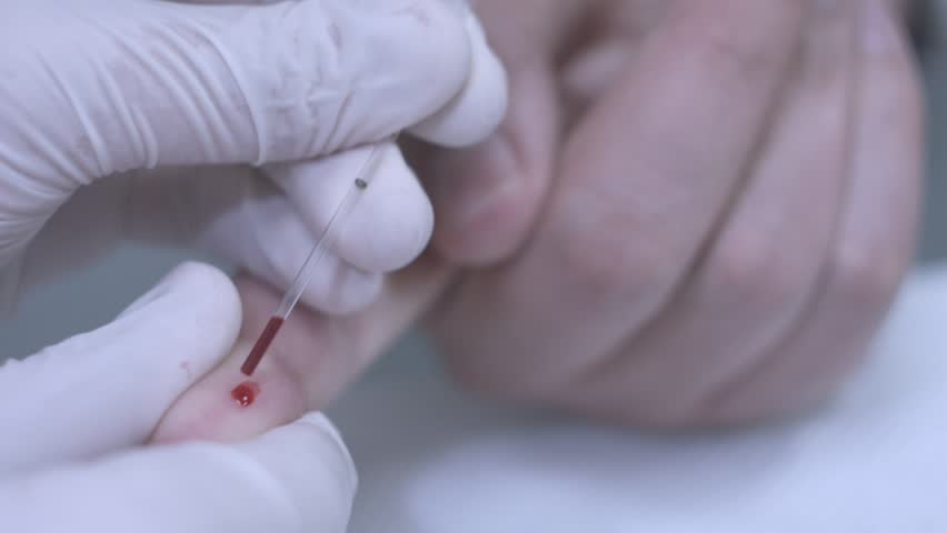 какие сдавать анализы перед курсом стероидов