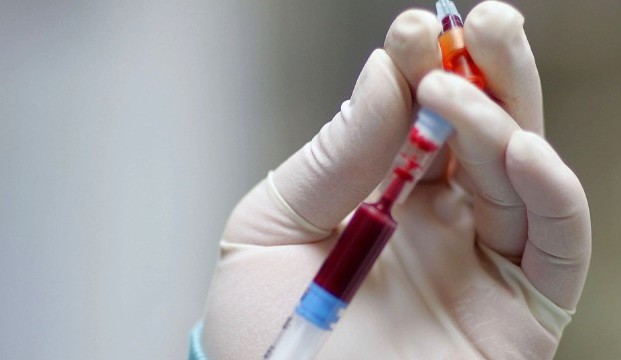 какие анализы сдают перед курсом стероидов