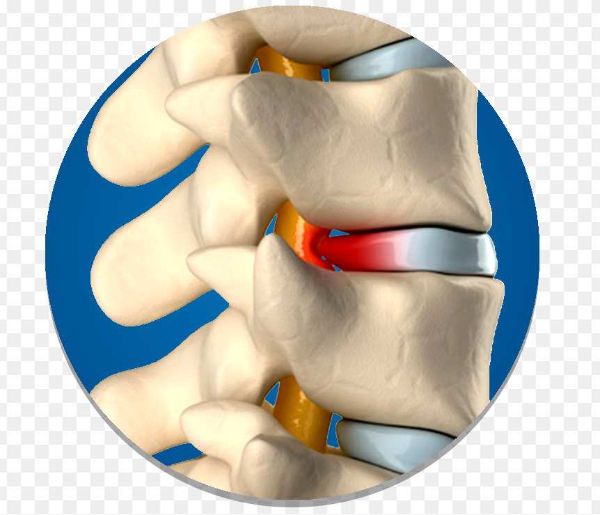 подтягивания обратным хватом какие мышцы качаются