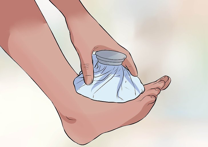 отек при растяжении связок стопы