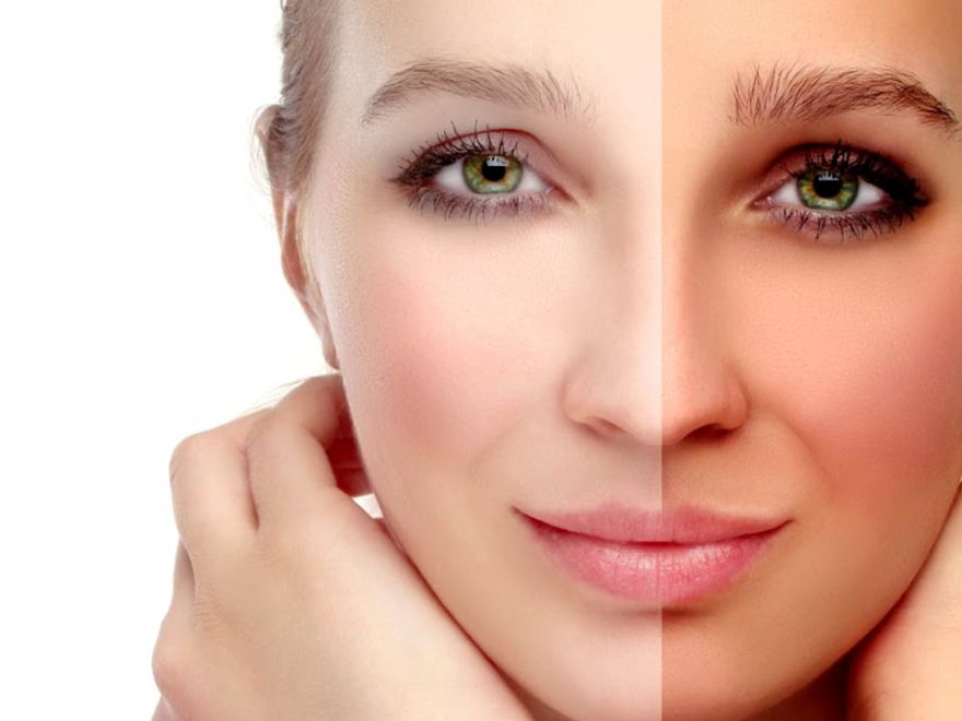 Пигментация кожи