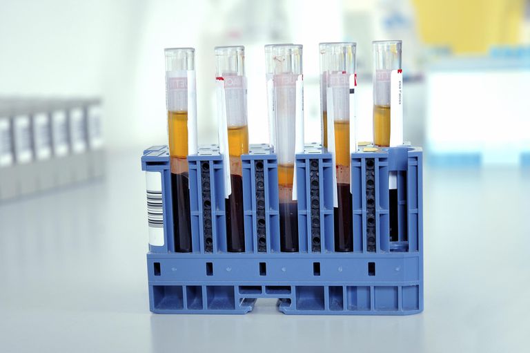 Кровь для исследований