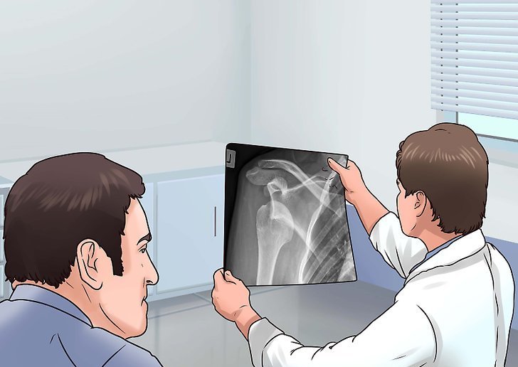 Врач смотрит на рентген.