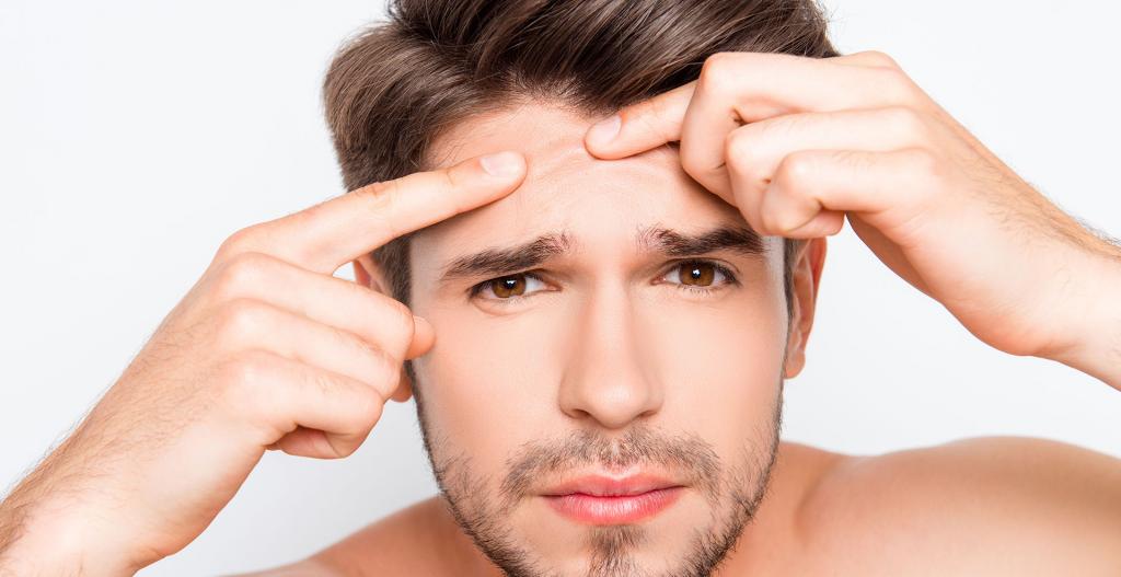 Лечение акне