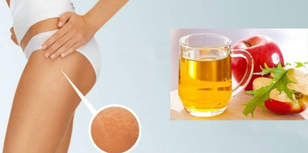 Обертывание с яблочным уксусом