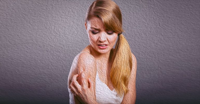 сухость кожи