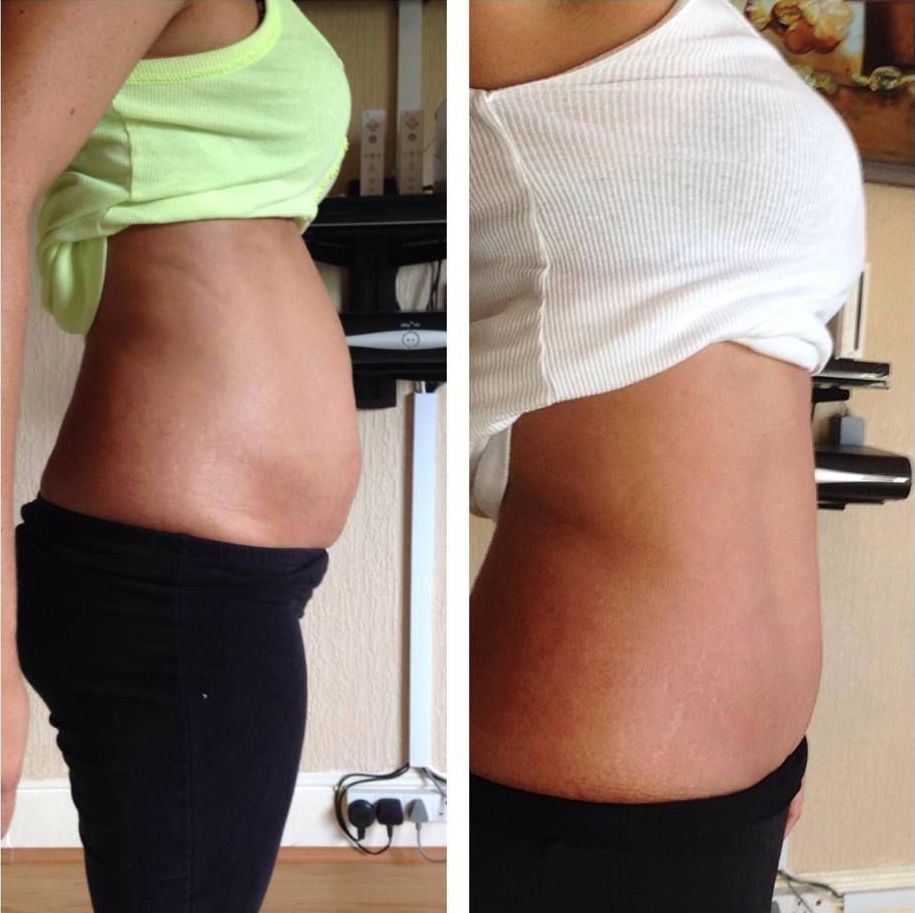 Похудение в области живота