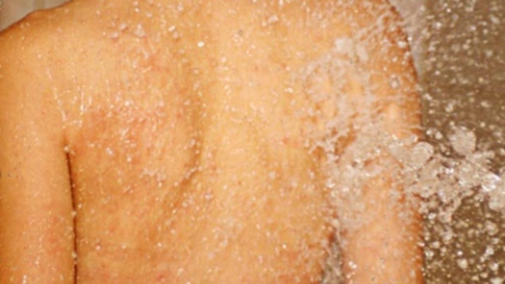 душ против целлюлита