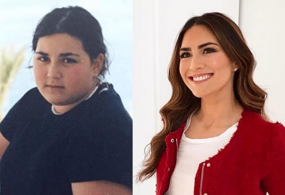 эстетическое преображение с помощью похудения