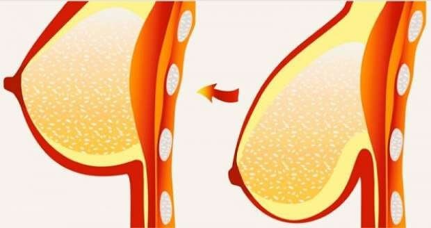 Грудь обвисла