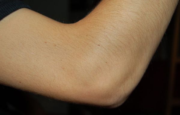 анатомия локтевого сустава человека