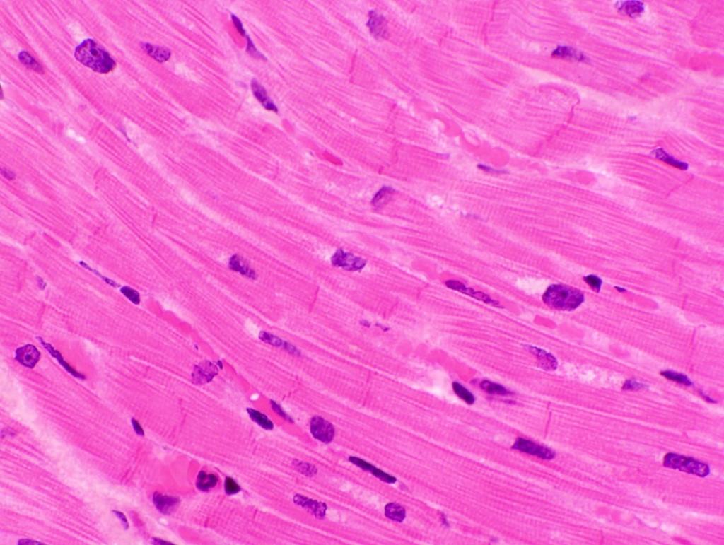 мышечная ткань