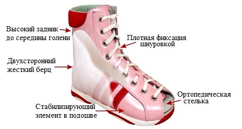 Ustroistvo slozhnoi ortopedicheskoi obuvi